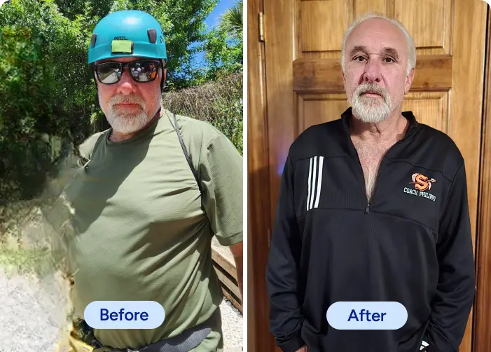 ken-p-before-after
